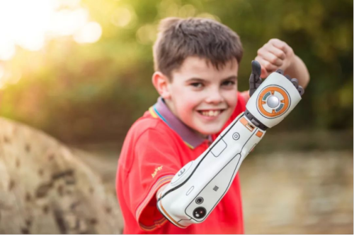 Hero Arm by Open Bionics