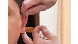 英国研究：常刺激耳朵 有助预防衰老和改善健康 
